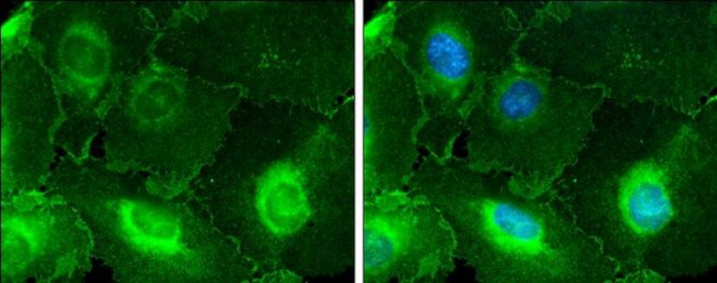 CD146 Antibody in Immunocytochemistry (ICC/IF)