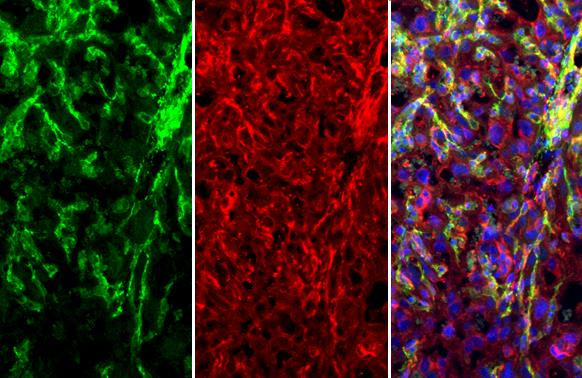 CD146 Antibody in Immunohistochemistry (Paraffin) (IHC (P))