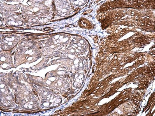 CD146 Antibody in Immunohistochemistry (Paraffin) (IHC (P))