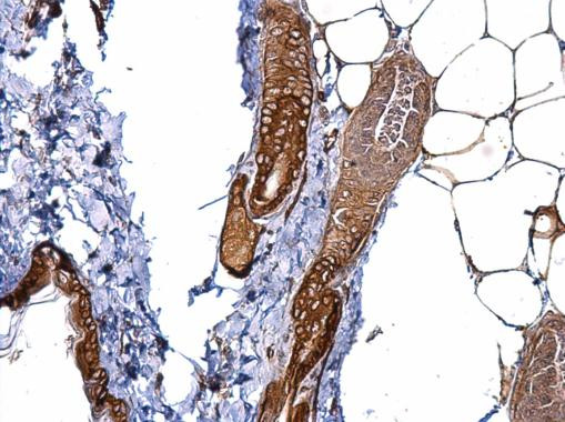 CD146 Antibody in Immunohistochemistry (Paraffin) (IHC (P))