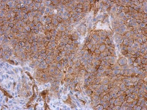 CD146 Antibody in Immunohistochemistry (Paraffin) (IHC (P))