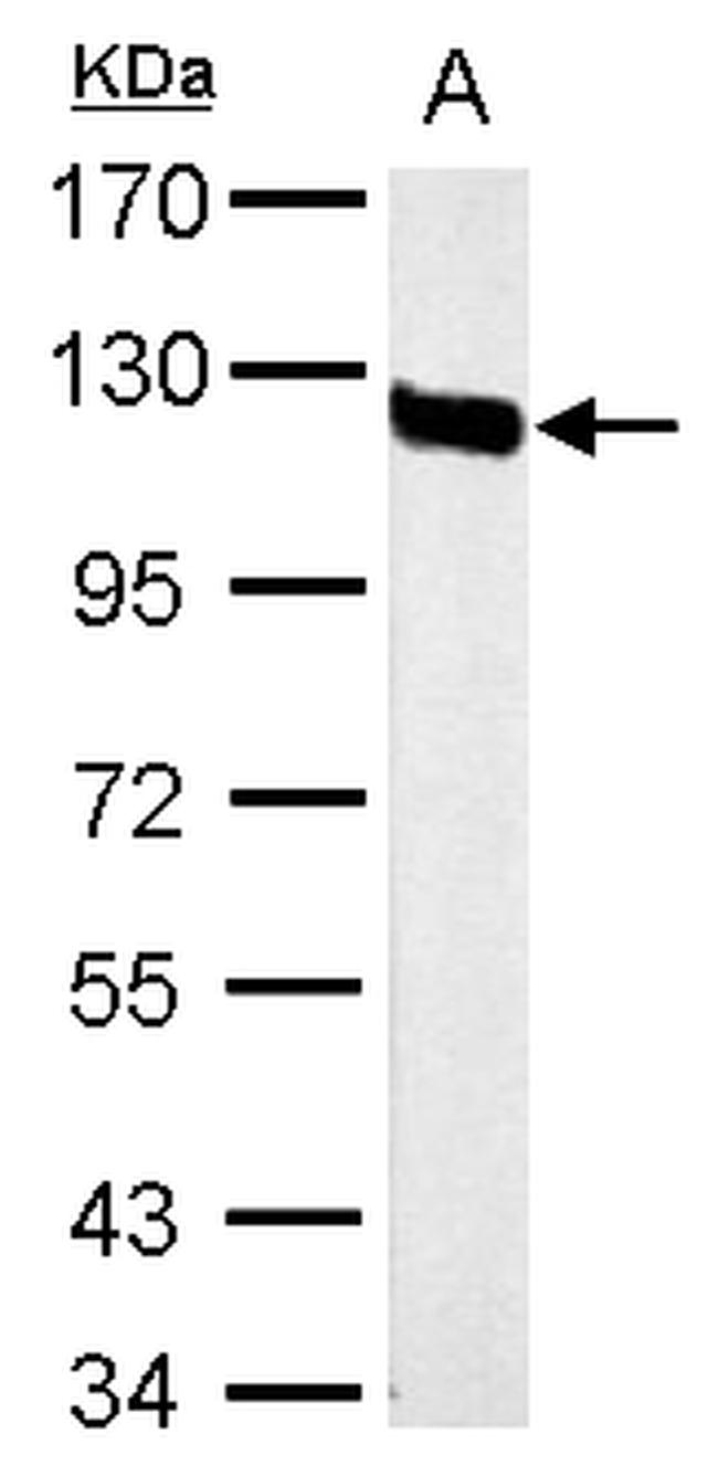 CD146 Antibody in Western Blot (WB)