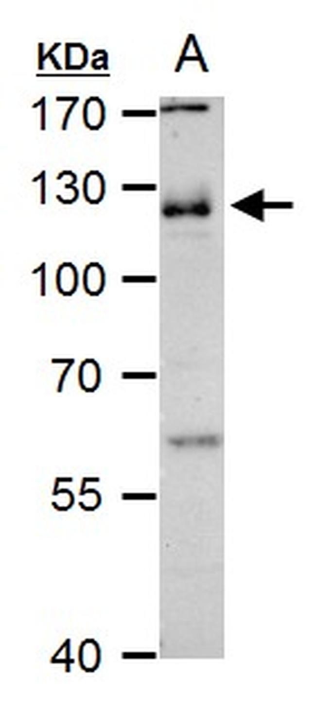 CD146 Antibody in Western Blot (WB)