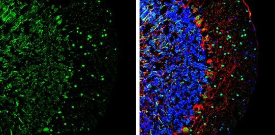 DLX1 Antibody in Immunohistochemistry (Frozen) (IHC (F))