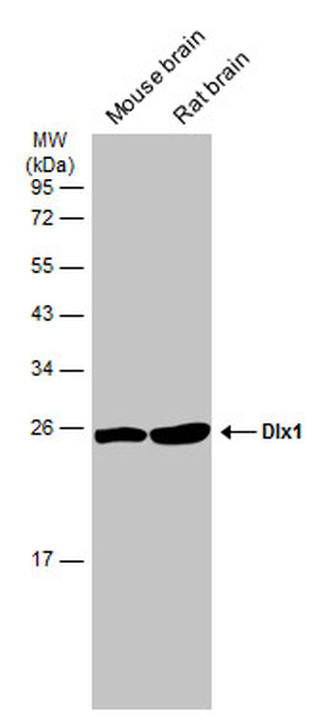 DLX1 Antibody in Western Blot (WB)