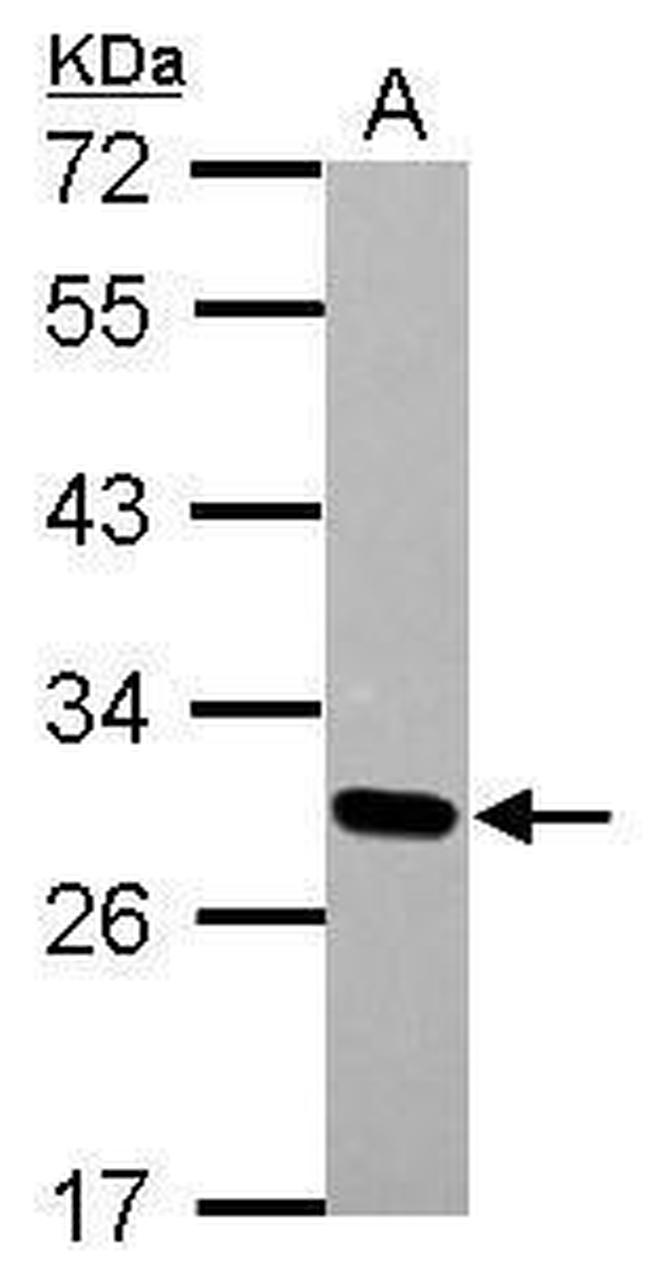 DLX1 Antibody in Western Blot (WB)