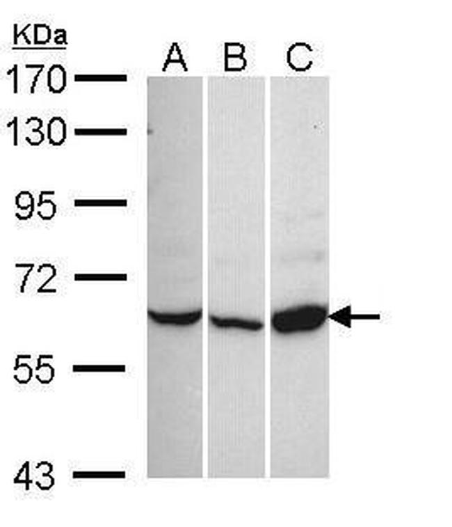 CACNB1 Antibody in Western Blot (WB)