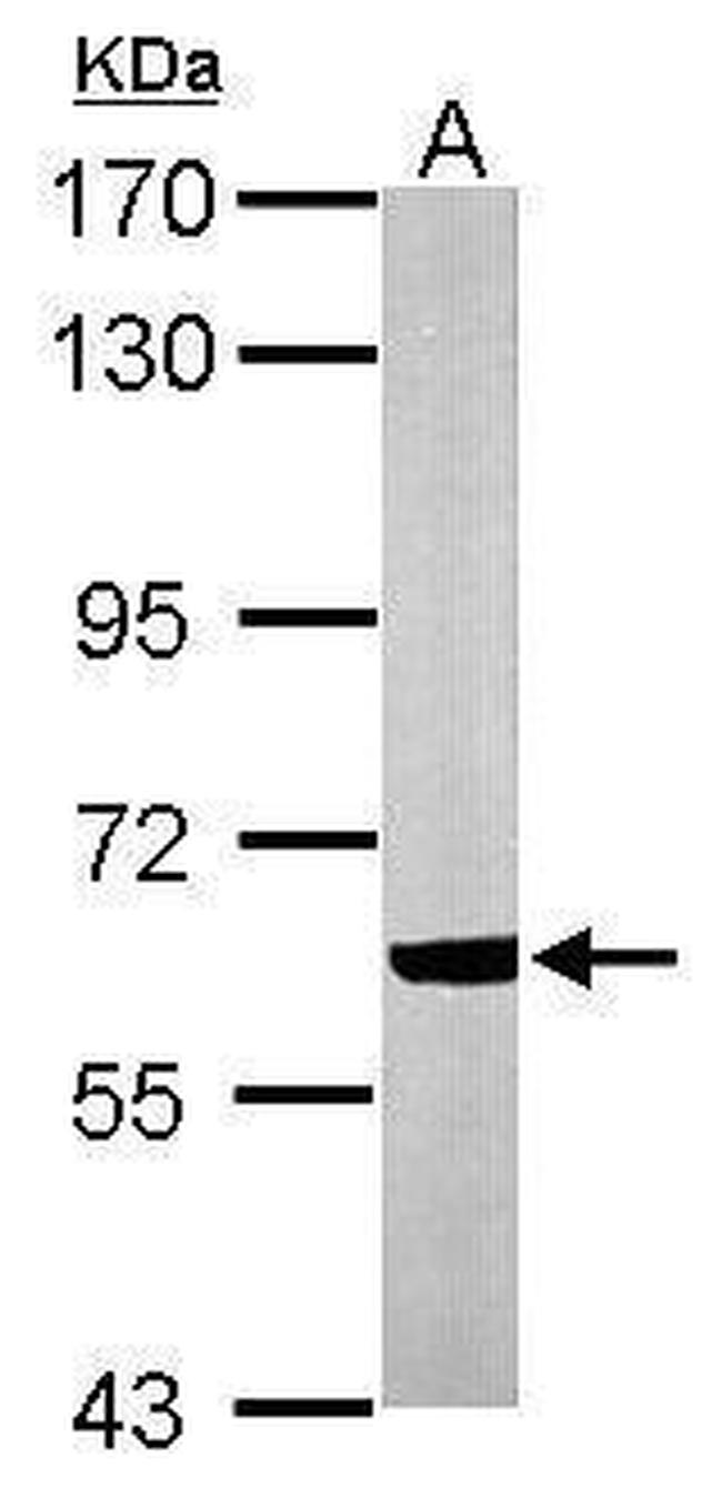 CACNB1 Antibody in Western Blot (WB)