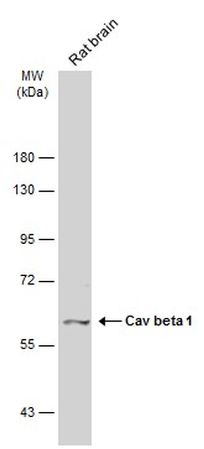 CACNB1 Antibody in Western Blot (WB)