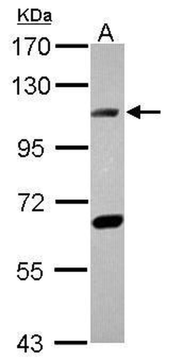 DNA ligase IV Antibody in Western Blot (WB)