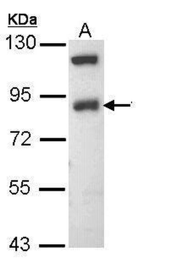SCNN1B Antibody in Western Blot (WB)