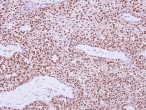 XPD Antibody in Immunohistochemistry (Paraffin) (IHC (P))