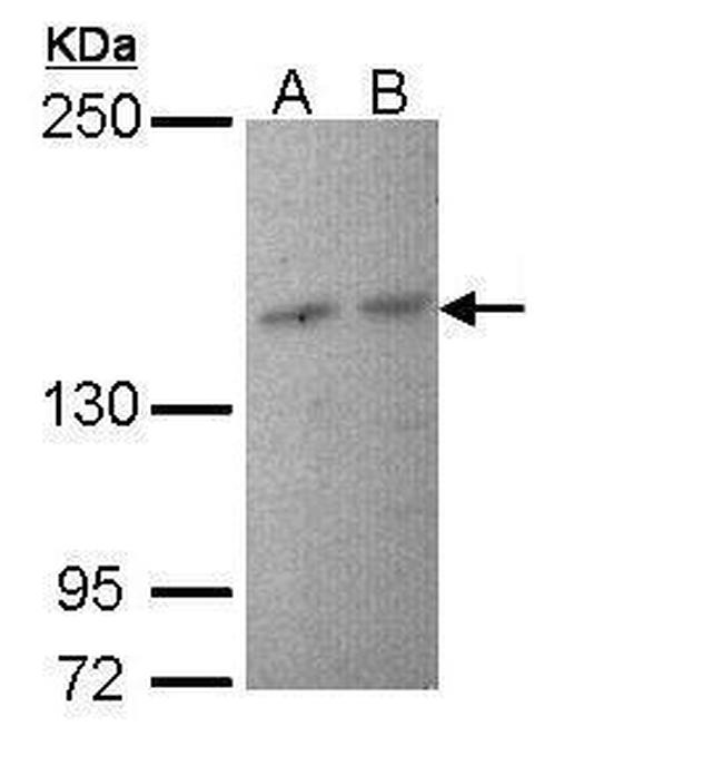 PIK3R4 Antibody in Western Blot (WB)