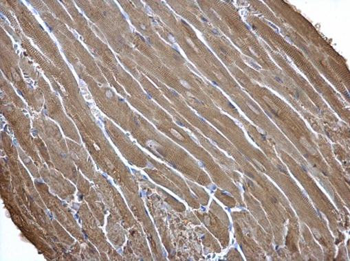 Creatine Kinase MB Antibody in Immunohistochemistry (Paraffin) (IHC (P))