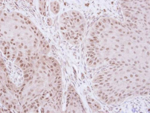 GTF2E2 Antibody in Immunohistochemistry (Paraffin) (IHC (P))