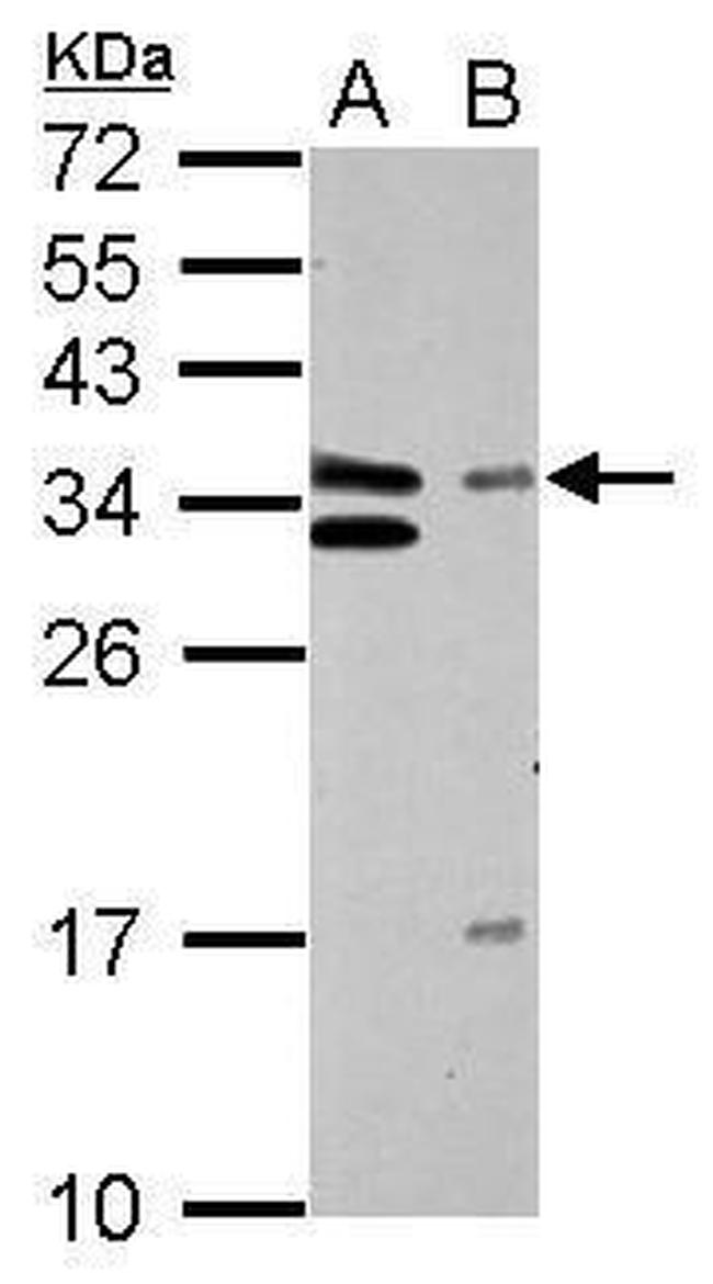 GTF2E2 Antibody in Western Blot (WB)