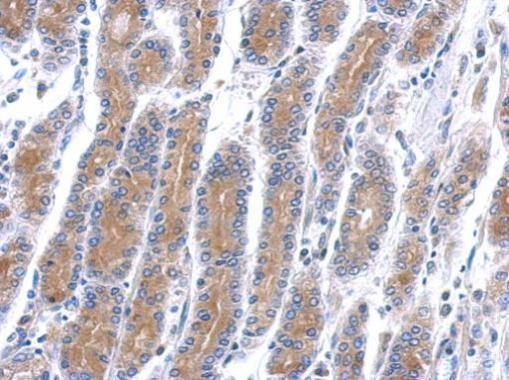 HSD17B6 Antibody in Immunohistochemistry (Paraffin) (IHC (P))