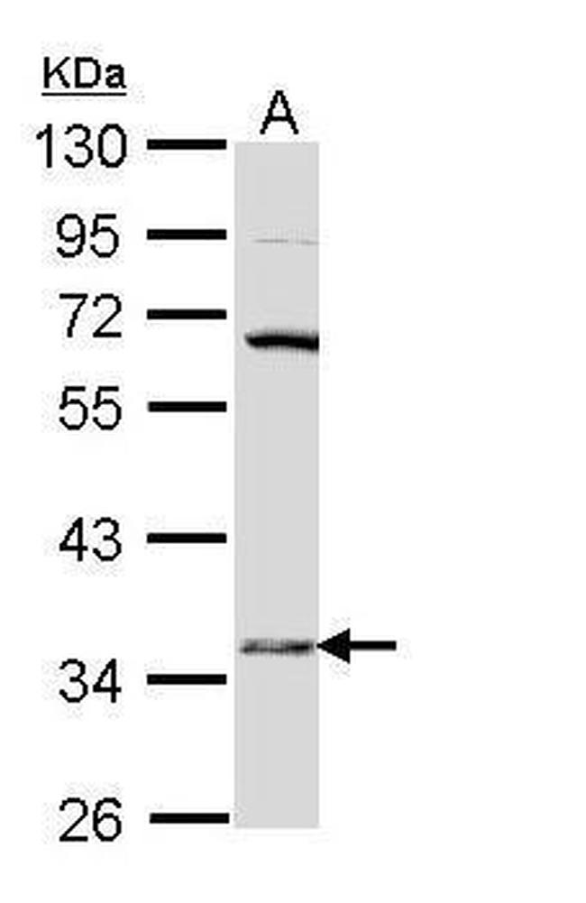 HSD17B6 Antibody in Western Blot (WB)