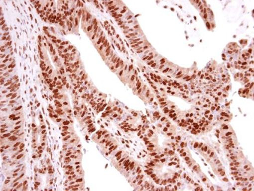 p73 Antibody in Immunohistochemistry (Paraffin) (IHC (P))