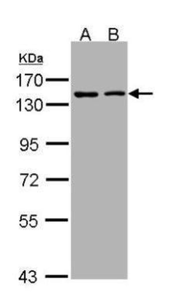 KIF11 Antibody in Western Blot (WB)