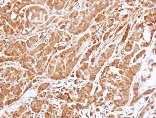 14-3-3 epsilon Antibody in Immunohistochemistry (Paraffin) (IHC (P))