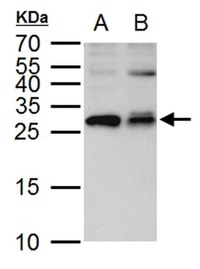 ETHE1 Antibody in Western Blot (WB)