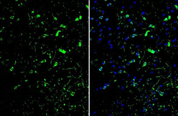 ID2 Antibody in Immunohistochemistry (Frozen) (IHC (F))