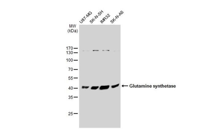 Glutamine Synthetase Antibody in Western Blot (WB)