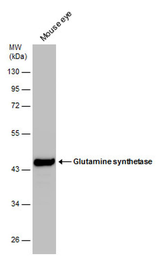 Glutamine Synthetase Antibody in Western Blot (WB)