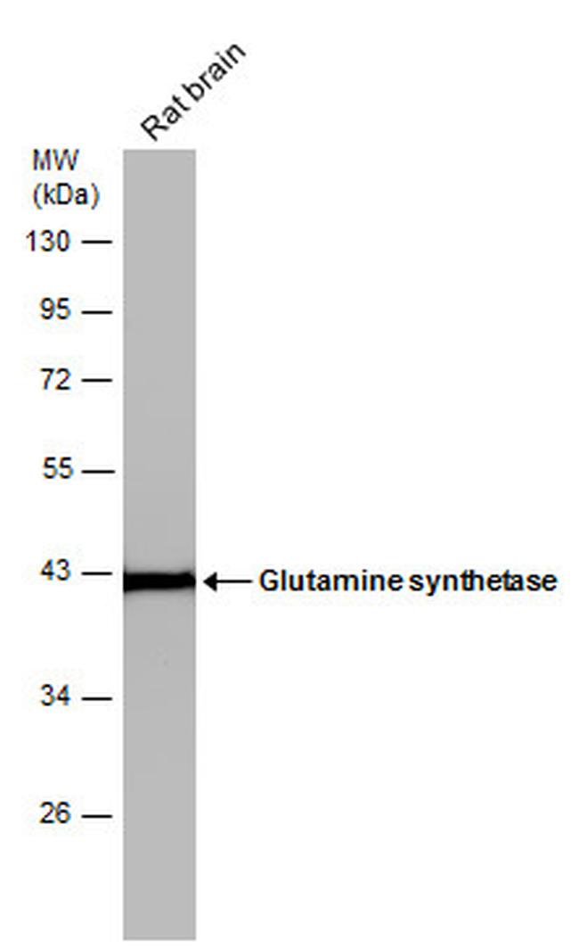 Glutamine Synthetase Antibody in Western Blot (WB)