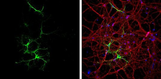 Glutamine Synthetase Antibody in Immunocytochemistry (ICC/IF)