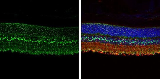 Glutamine Synthetase Antibody in Immunohistochemistry (Paraffin) (IHC (P))