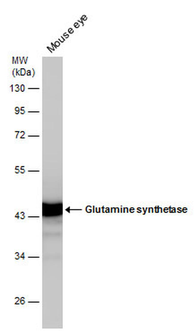 Glutamine Synthetase Antibody in Western Blot (WB)