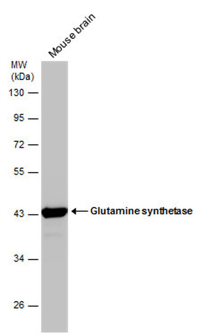 Glutamine Synthetase Antibody in Western Blot (WB)