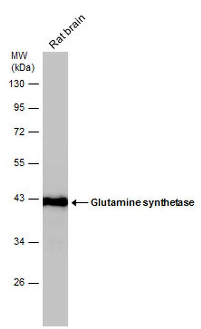 Glutamine Synthetase Antibody in Western Blot (WB)