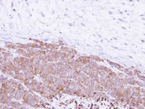 GGH Antibody in Immunohistochemistry (Paraffin) (IHC (P))