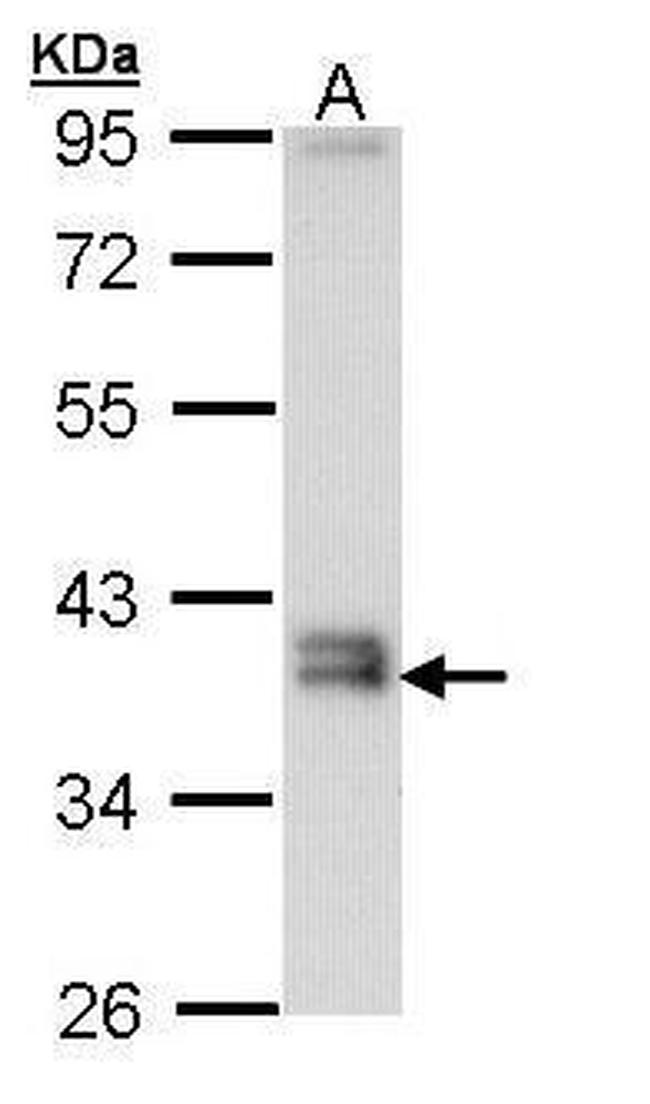 GGH Antibody in Western Blot (WB)