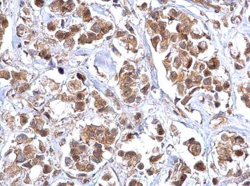 Bcl-10 Antibody in Immunohistochemistry (Paraffin) (IHC (P))