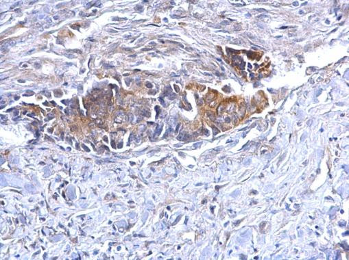 Bcl-10 Antibody in Immunohistochemistry (Paraffin) (IHC (P))