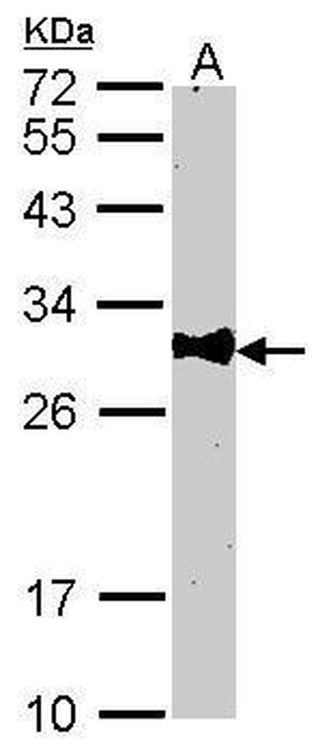 Bcl-10 Antibody in Western Blot (WB)