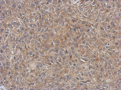 4EBP1 Antibody in Immunohistochemistry (Paraffin) (IHC (P))