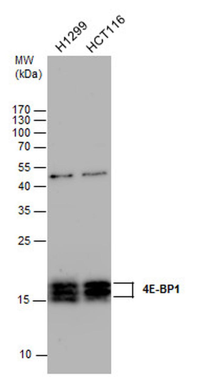 4EBP1 Antibody in Western Blot (WB)