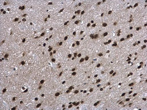 Aprataxin Antibody in Immunohistochemistry (Paraffin) (IHC (P))