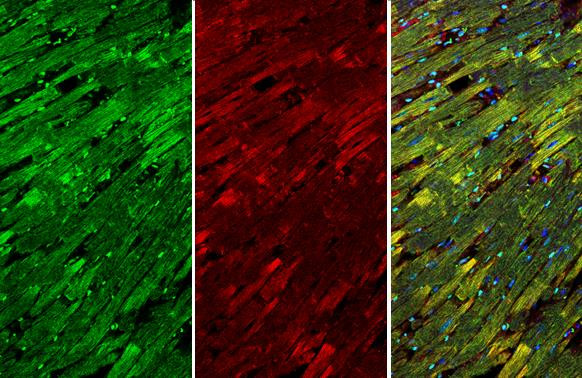 Cardiac Troponin I Antibody in Immunohistochemistry (Paraffin) (IHC (P))