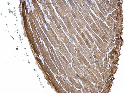 Cardiac Troponin I Antibody in Immunohistochemistry (Paraffin) (IHC (P))