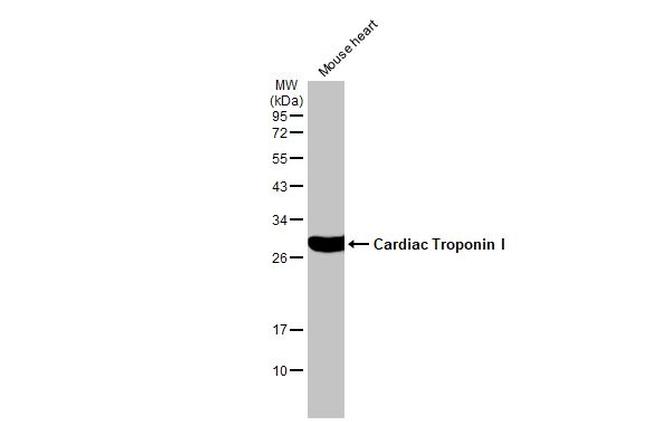 Cardiac Troponin I Antibody in Western Blot (WB)