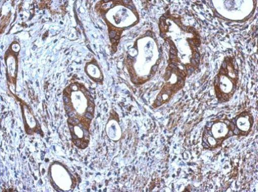 CNDP1 Antibody in Immunohistochemistry (Paraffin) (IHC (P))