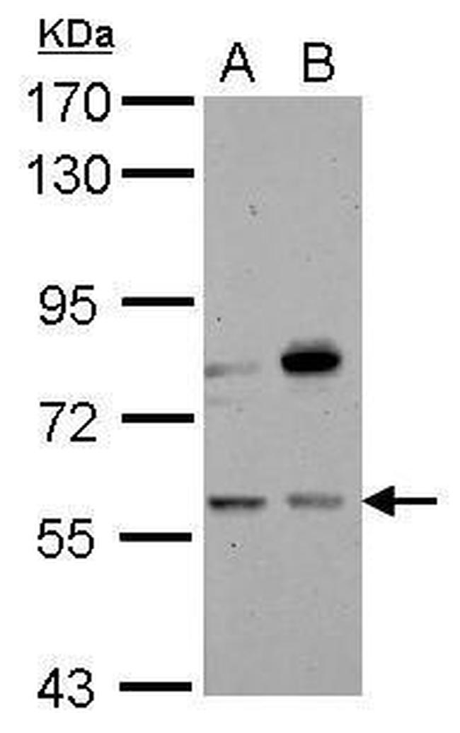 CNDP1 Antibody in Western Blot (WB)