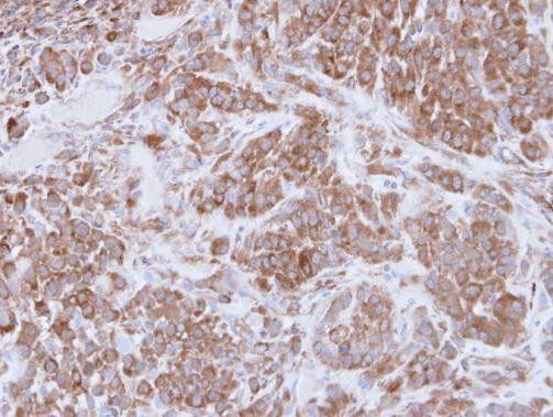 MMP16 Antibody in Immunohistochemistry (Paraffin) (IHC (P))