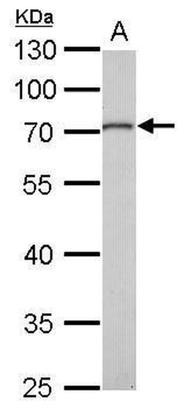 MMP16 Antibody in Western Blot (WB)